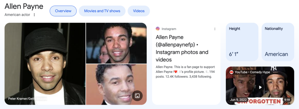 The popular actor Allen Payne has a light skin